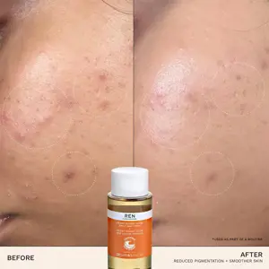 REN Radiance Ready Steady Glow Daily AHA Tonic 100ml